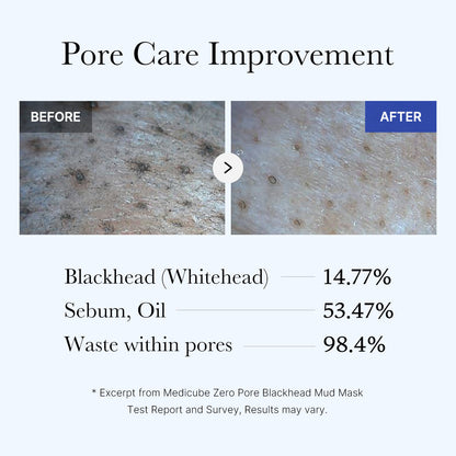 [Subscr.] Zero Pore Blackhead Mud Mask
